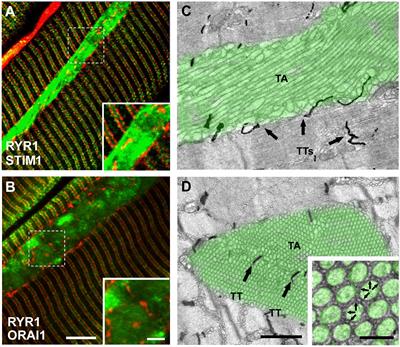 Long-Term Exercise Reduces Formation of Tubular Aggregates and Promotes Maintenance of Ca2+ Entry Units in Aged Muscle